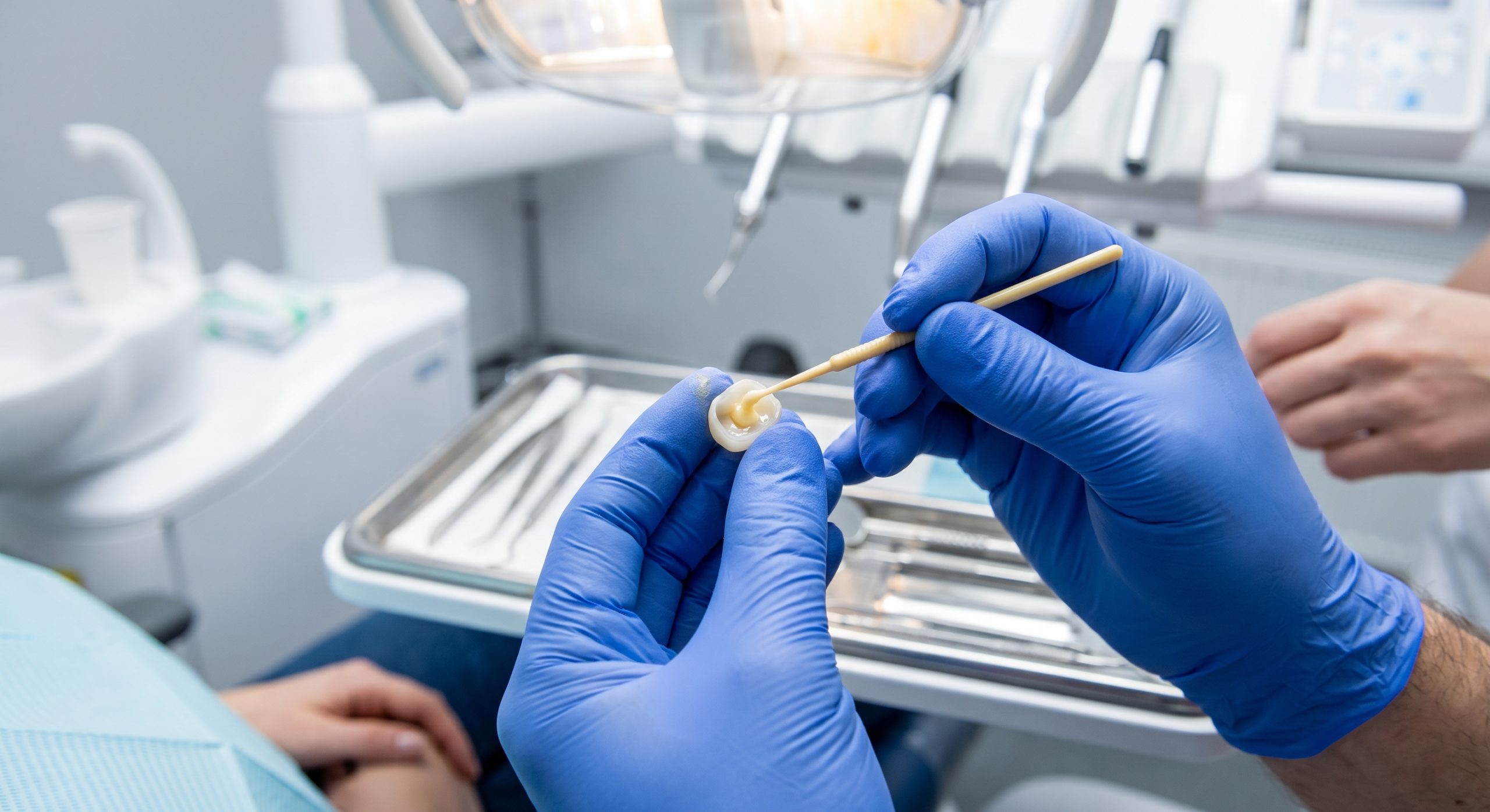Applying chemical MDP primer to crown