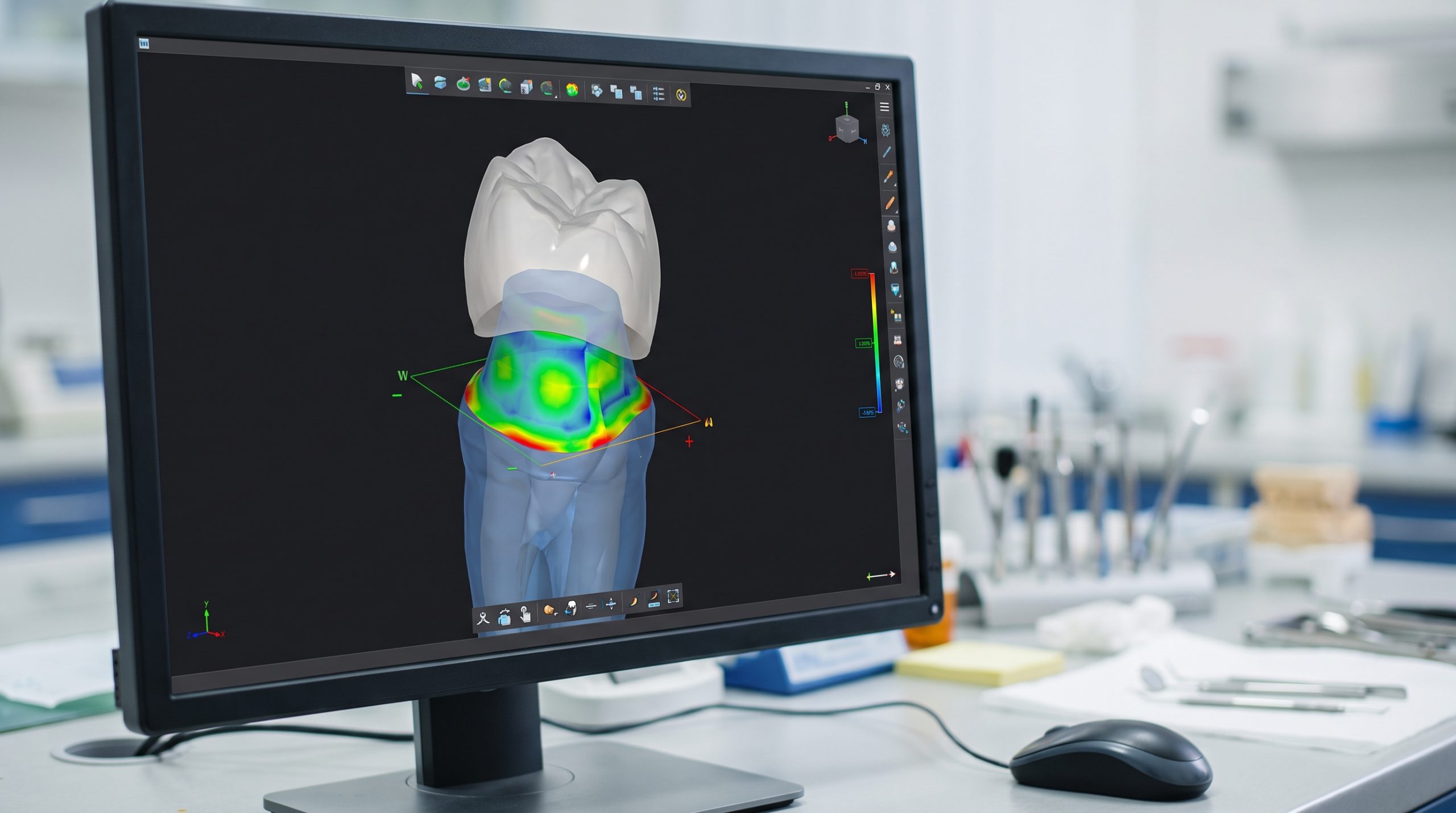 CAD/CAM design screen of a zirconia crown